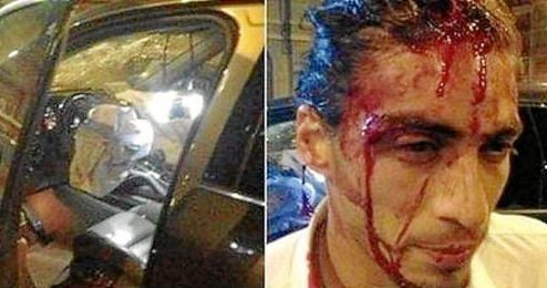 Cáceres ya sufrió otro aparatoso accidente el pasado mes de marzo. Cáceres ya sufrió otro aparatoso accidente el pasado mes de marzo.