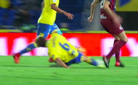 Posible lesión de tibia y peroné de Samper Posible lesión de tibia y peroné de Samper
