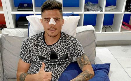 Narváez sufre una fractura de nariz. Narváez sufre una fractura de nariz.